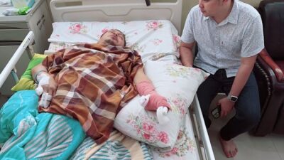 Wabup Kaur Jalani Operasi Usai Tangannya Terkena Ledakan Petasan, Hasilnya…