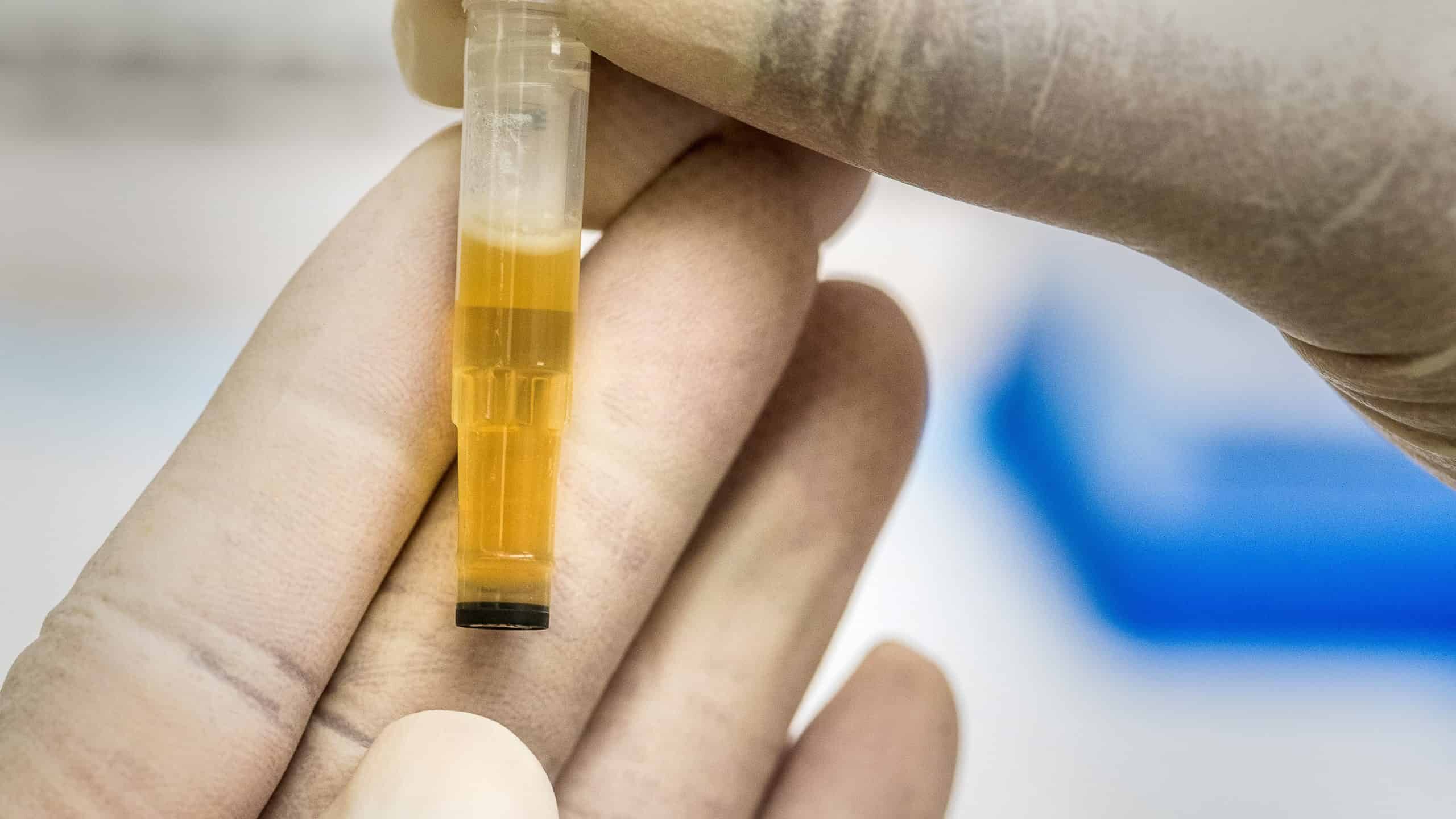 Geger Balita di Samarinda Positif Narkoba, Begini Kronologinya