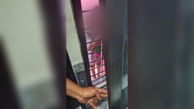 Biadab! Bocah Lima Tahun Disekap dan Dianiaya hingga Patah Tulang Kaki